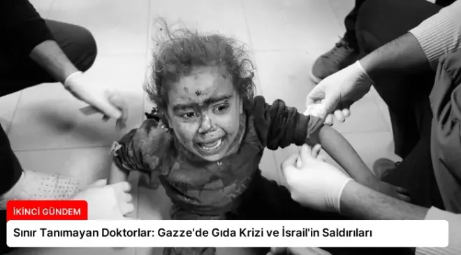Sınır Tanımayan Doktorlar: Gazze’de Gıda Krizi ve İsrail’in Saldırıları