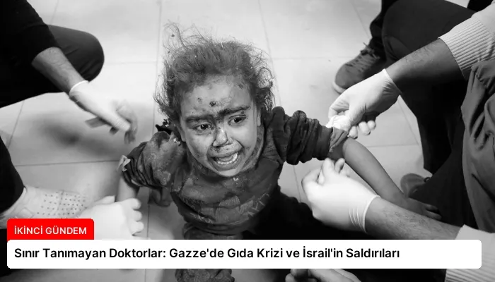Sınır Tanımayan Doktorlar: Gazze’de Gıda Krizi ve İsrail’in Saldırıları